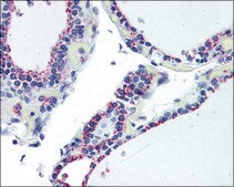 Anti-ADORA2B antibody produced in rabbit affinity isolated antibody