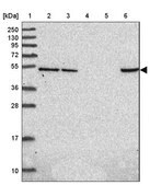 Anti-HDAC3 antibody produced in rabbit Prestige Antibodies&#174; Powered by Atlas Antibodies, affinity isolated antibody, buffered aqueous glycerol solution