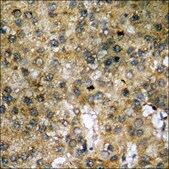 Anti-phospho-IkappaB-&#945; (pSer32/36) antibody produced in rabbit affinity isolated antibody