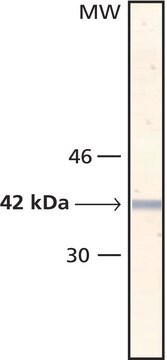 Anti-Actin, &#945;-Smooth Muscle - Alkaline Phosphatase antibody, Mouse monoclonal clone 1A4, purified from hybridoma cell culture