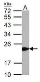 Anti-GPX1 antibody produced in rabbit affinity isolated antibody, buffered aqueous solution