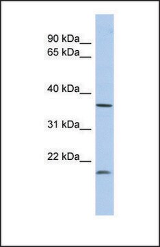 Anti-MTHFD2L antibody produced in rabbit affinity isolated antibody