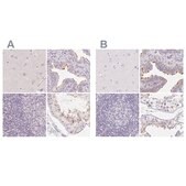 Anti-ZBBX antibody produced in rabbit Prestige Antibodies&#174; Powered by Atlas Antibodies, affinity isolated antibody, buffered aqueous glycerol solution