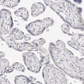 Anti-FDPS antibody produced in rabbit Prestige Antibodies&#174; Powered by Atlas Antibodies, affinity isolated antibody, buffered aqueous glycerol solution