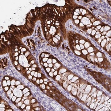 Anti-DEFB115 antibody produced in rabbit Prestige Antibodies&#174; Powered by Atlas Antibodies, affinity isolated antibody, buffered aqueous glycerol solution