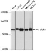 Anti-PKC alpha Antibody, clone 1G10S8, Rabbit Monoclonal