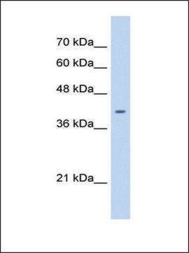 Anti-ST6GALNAC6 antibody produced in rabbit affinity isolated antibody