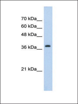 Anti-CBX6 (AB2) antibody produced in rabbit IgG fraction of antiserum