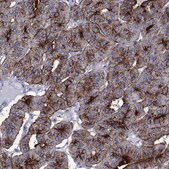 Anti-DPP4 antibody produced in rabbit Prestige Antibodies&#174; Powered by Atlas Antibodies, affinity isolated antibody, buffered aqueous glycerol solution