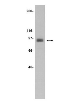 Anti-PKC&#949; Antibody Upstate&#174;, from rabbit