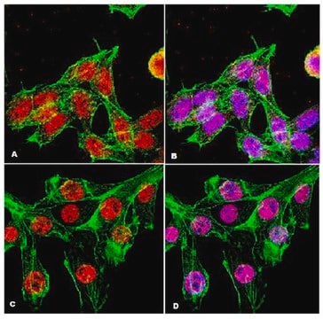 Anti-ATM Antibody Upstate&#174;, from rabbit