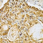 Anti-ADRBK1 antibody produced in rabbit