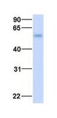 Anti-ADRB2 affinity isolated antibody