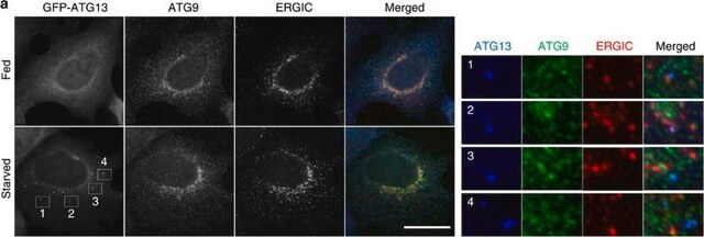 Anti-Atg13 Antibody, clone 2H4.2 clone 2H4.2, from mouse