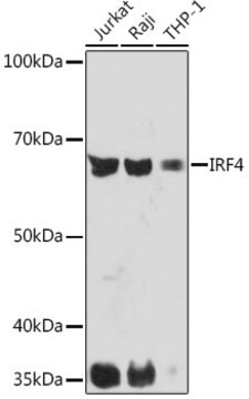 Anti-IRF4 Antibody, clone 2U3G10, Rabbit Monoclonal