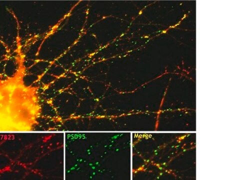 Anti-Drebrin A/E Antibody from rabbit, purified by affinity chromatography