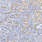 Anti-Caspase-9 Antibody, clone 8I9T3, Rabbit Monoclonal