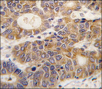 Anti-APOD (N-term) antibody produced in rabbit saturated ammonium sulfate (SAS) precipitated, buffered aqueous solution