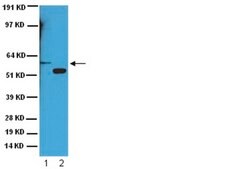 Anti-Cytochrome P450 Enzyme CYP2E1 Antibody serum, Chemicon&#174;