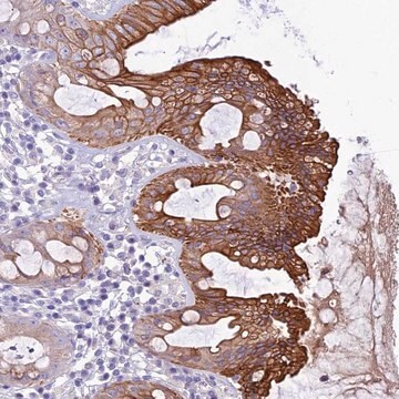 Anti-QSOX1 antibody produced in rabbit Prestige Antibodies&#174; Powered by Atlas Antibodies, affinity isolated antibody, buffered aqueous glycerol solution