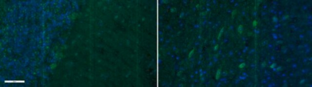 Anti-Metabotropic Glutamate Receptor 5 Antibody, Alexa Fluor&#8482; 488 from rabbit, ALEXA FLUOR&#8482; 488