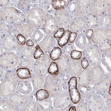 Anti-MAP3K13 antibody produced in rabbit Prestige Antibodies&#174; Powered by Atlas Antibodies, affinity isolated antibody, buffered aqueous glycerol solution