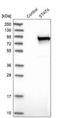 Anti-STAT4 antibody produced in rabbit Prestige Antibodies&#174; Powered by Atlas Antibodies, affinity isolated antibody, buffered aqueous glycerol solution