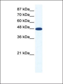 Anti-ACCN5 antibody produced in rabbit IgG fraction of antiserum