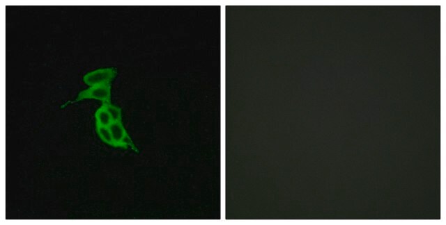Anti-GPR143 antibody produced in rabbit affinity isolated antibody