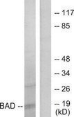 Anti-BAD antibody produced in rabbit affinity isolated antibody