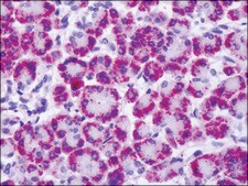 Anti-GRM4 / MGLUR4 antibody produced in rabbit affinity isolated antibody