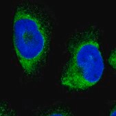 Anti-ERLIN1 antibody produced in rabbit affinity isolated antibody, buffered aqueous glycerol solution