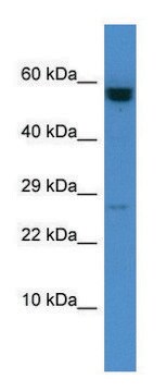 Anti-CASP10 (C-terminal) antibody produced in rabbit affinity isolated antibody