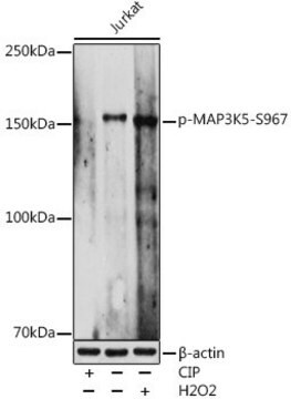 Anti-Phospho-MAP3K5-S967 antibody produced in rabbit