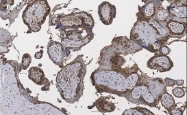 Anti-BCRP (ABCG2) Antibody, clone 10K5 , ZooMAb&#174; Rabbit Monoclonal recombinant, expressed in HEK 293 cells