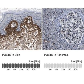 Anti-POSTN antibody produced in rabbit Prestige Antibodies&#174; Powered by Atlas Antibodies, affinity isolated antibody, buffered aqueous glycerol solution