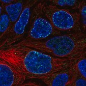 Anti-CACNA1D antibody produced in rabbit Prestige Antibodies&#174; Powered by Atlas Antibodies, affinity isolated antibody, buffered aqueous glycerol solution