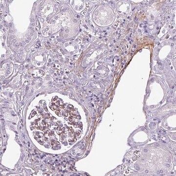 Anti-ATP10A antibody produced in rabbit Prestige Antibodies&#174; Powered by Atlas Antibodies, affinity isolated antibody, buffered aqueous glycerol solution
