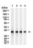 Anti-LDH-A Antibody, clone 1I7 ZooMAb&#174; Rabbit Monoclonal recombinant, expressed in HEK 293 cells