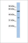 Anti-AKR1B1 antibody produced in rabbit affinity isolated antibody