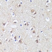Anti- LC3B antibody produced in rabbit