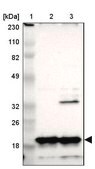 Anti-NDUFB8 antibody produced in rabbit Prestige Antibodies&#174; Powered by Atlas Antibodies, affinity isolated antibody, buffered aqueous glycerol solution