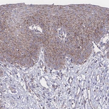 Anti-PEX14 antibody produced in rabbit Prestige Antibodies&#174; Powered by Atlas Antibodies, affinity isolated antibody, buffered aqueous glycerol solution