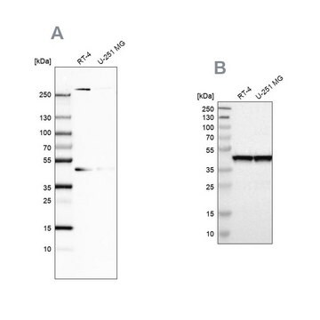 Anti-SMARCB1 antibody produced in rabbit Prestige Antibodies&#174; Powered by Atlas Antibodies, affinity isolated antibody, buffered aqueous glycerol solution