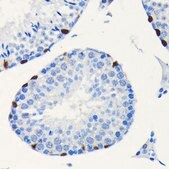 Anti-SOX9 antibody produced in rabbit