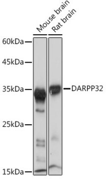 Anti-DARPP32 Antibody, clone 5T9G4, Rabbit Monoclonal
