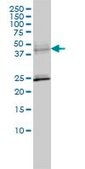Monoclonal Anti-SERPINA6 antibody produced in mouse clone 1D9, purified immunoglobulin, buffered aqueous solution