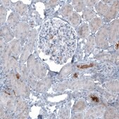 Monoclonal Anti-AFP antibody produced in mouse Prestige Antibodies&#174; Powered by Atlas Antibodies, clone CL9772, purified immunoglobulin, buffered aqueous glycerol solution