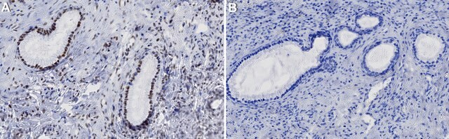 Anti-m3G/TMG cap Antibody, clone K121 ZooMAb&#174; Mouse Monoclonal recombinant, expressed in HEK 293 cells