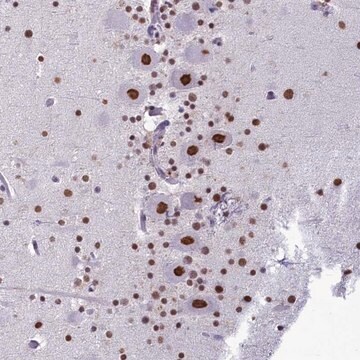 Anti-PARPBP antibody produced in rabbit Prestige Antibodies&#174; Powered by Atlas Antibodies, affinity isolated antibody, buffered aqueous glycerol solution